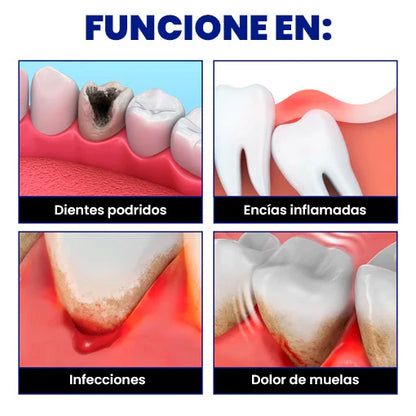 DENTIX - SPRAY DOLOR DE MUELAS