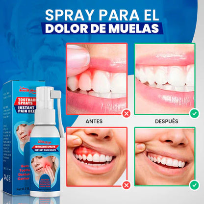 DENTIX - SPRAY DOLOR DE MUELAS