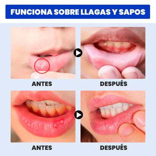 DENTIX - SPRAY DOLOR DE MUELAS